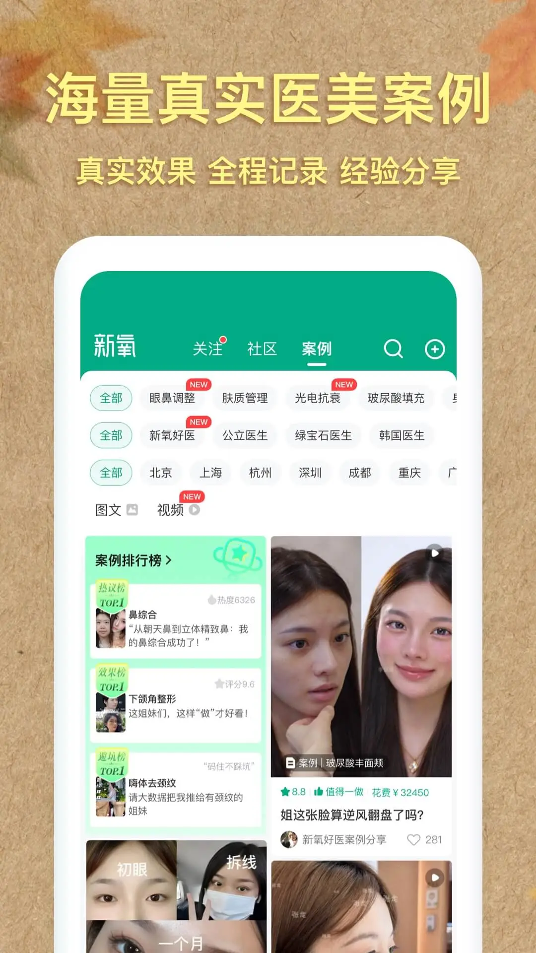 新氧极速版图4